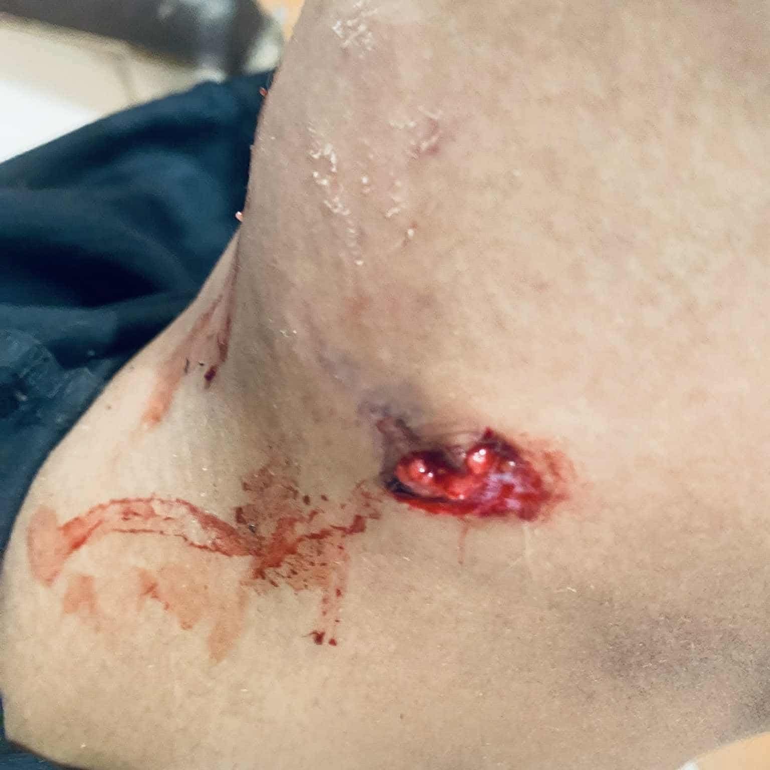 غضب بين الأهالي بسبب انتشار الكلاب الضالة ومطالبات بالتدخل العاجل