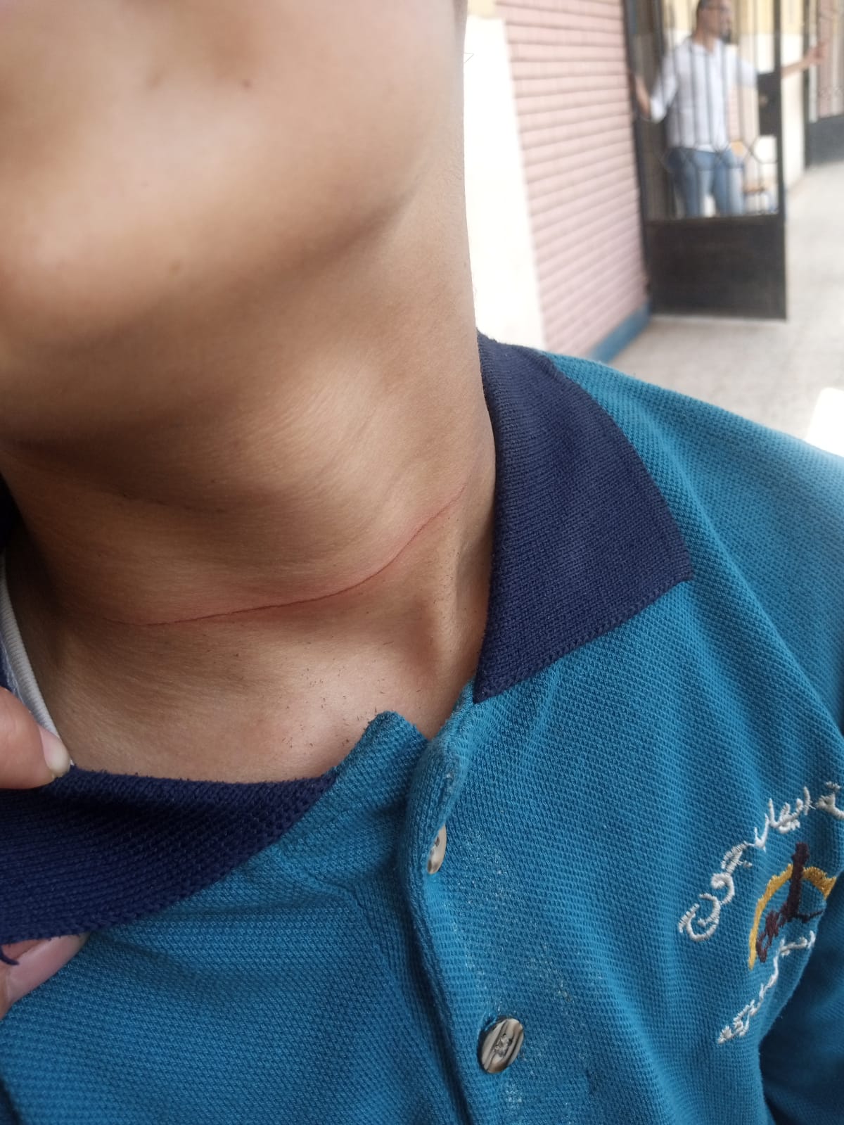 استغاثة ولي أمر لوزبر التربية والتعليم…طالب يعتدي على طالب بالصف الخامس الابتدائي داخل مدرسة ابتدائية فى الخصوص بالقليوبية وكاد أن يذبح فى رقبته