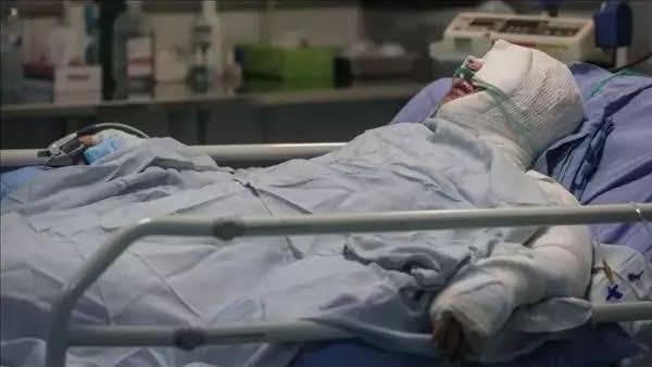 شاب في حالة حرجة بعد سقوط مادة كاوية عليه في بورسعيد