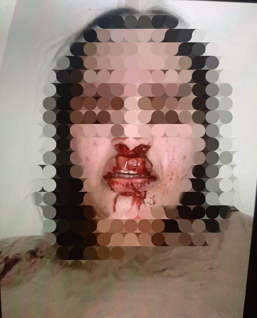 جريمة تهز دمياط.. زوج يعتدي بوحشية على زوجته وهي تحمل رضيعها بقرية الضهرة بفارسكور