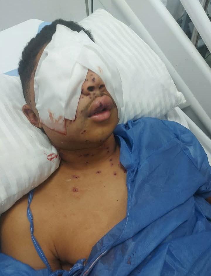 شاب يفقد عينيه في مشاجرة بسبب «صفحة وهمية» على تيك توك بقرية المناصرة