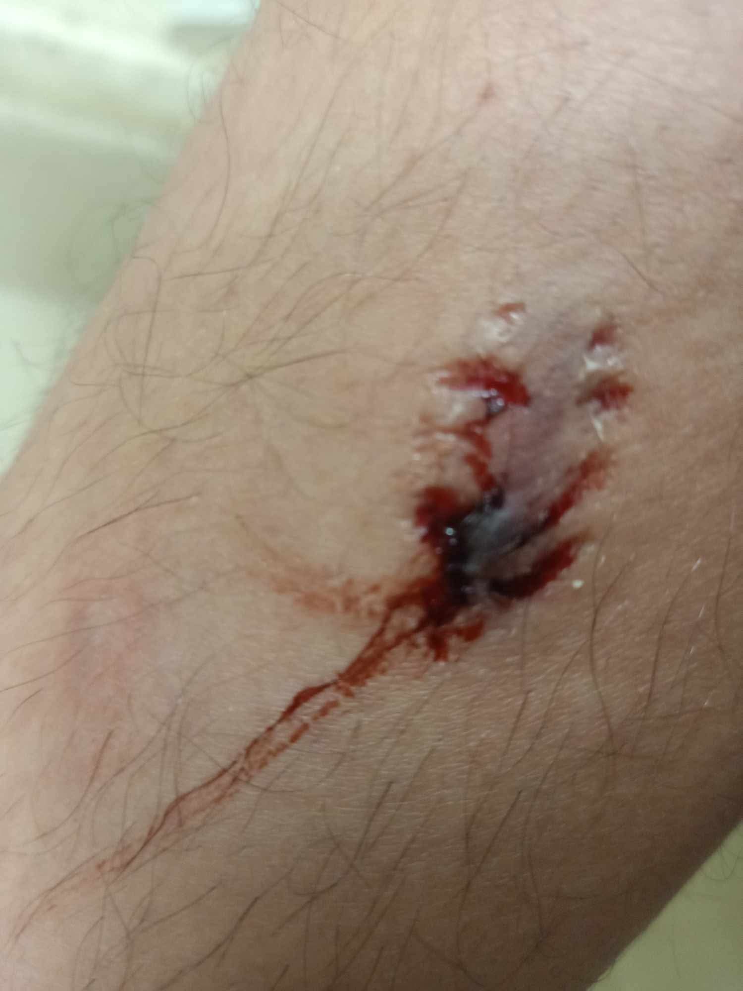 كلب ضال يهاجم أحد السكان بمنطقة التعاونيات ببورسعيد ويمزق ملابسه.. ومطالب بتحرك عاجل