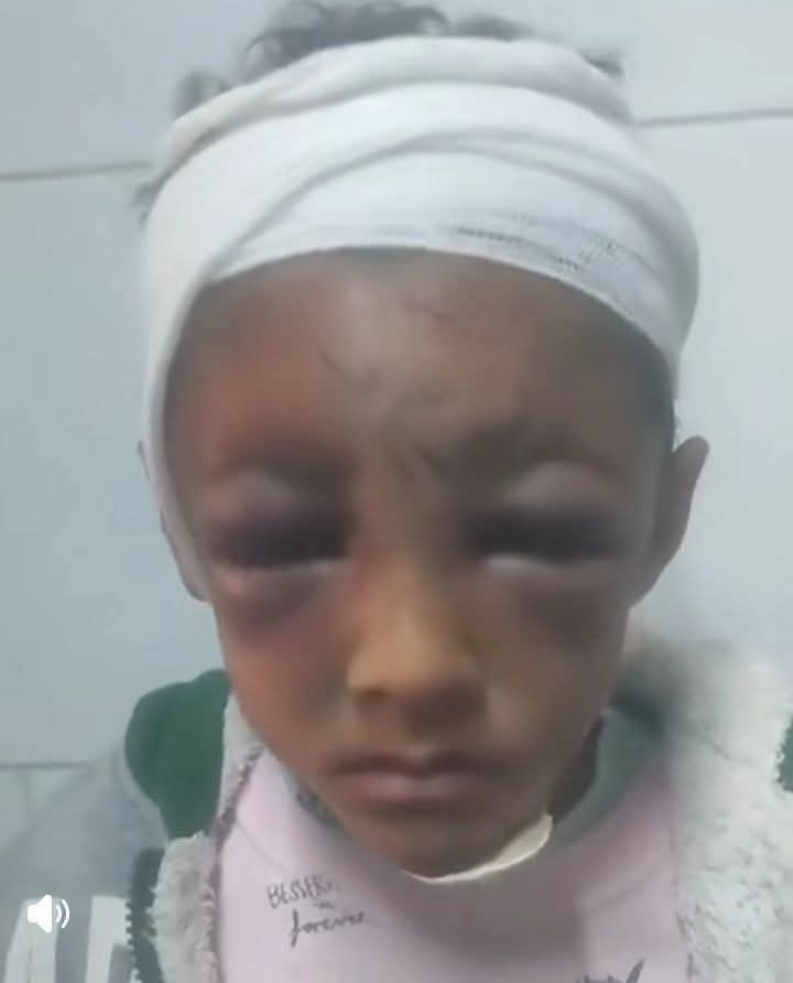 أب يعذب ابنه بعد ضياع 10 جنيهات لشراء سجائر فرط بالمحلة