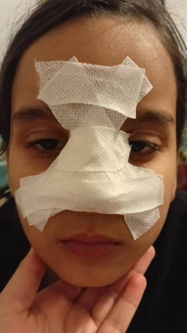 واقعة صادمة بمدرسة أم الشهداء ب ابوسليم.. مشرفة تعتدي على تلميذة وتكسر أنفها وسط مطالبات بالتحقيق