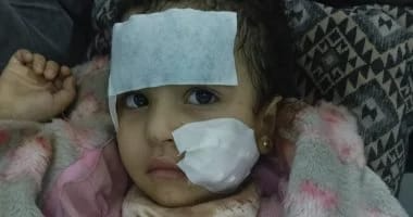 طفلة ضحية هجوم أسد عليها فى السيرك خلال العرض